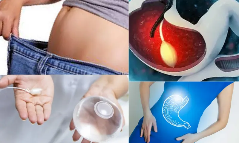 Zayıflama Ameliyatı ile Hangi Hastalıklar Önlenebilir?