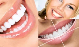 Diş Tasarımı Nedir ve Neden Önemlidir?