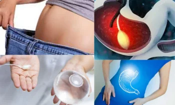 Zayıflama Ameliyatı ile Hangi Hastalıklar Önlenebilir?