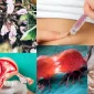 Azosperm Nedir?