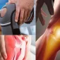 Menisküs Rahatsızlığında Tedavi Nedir?